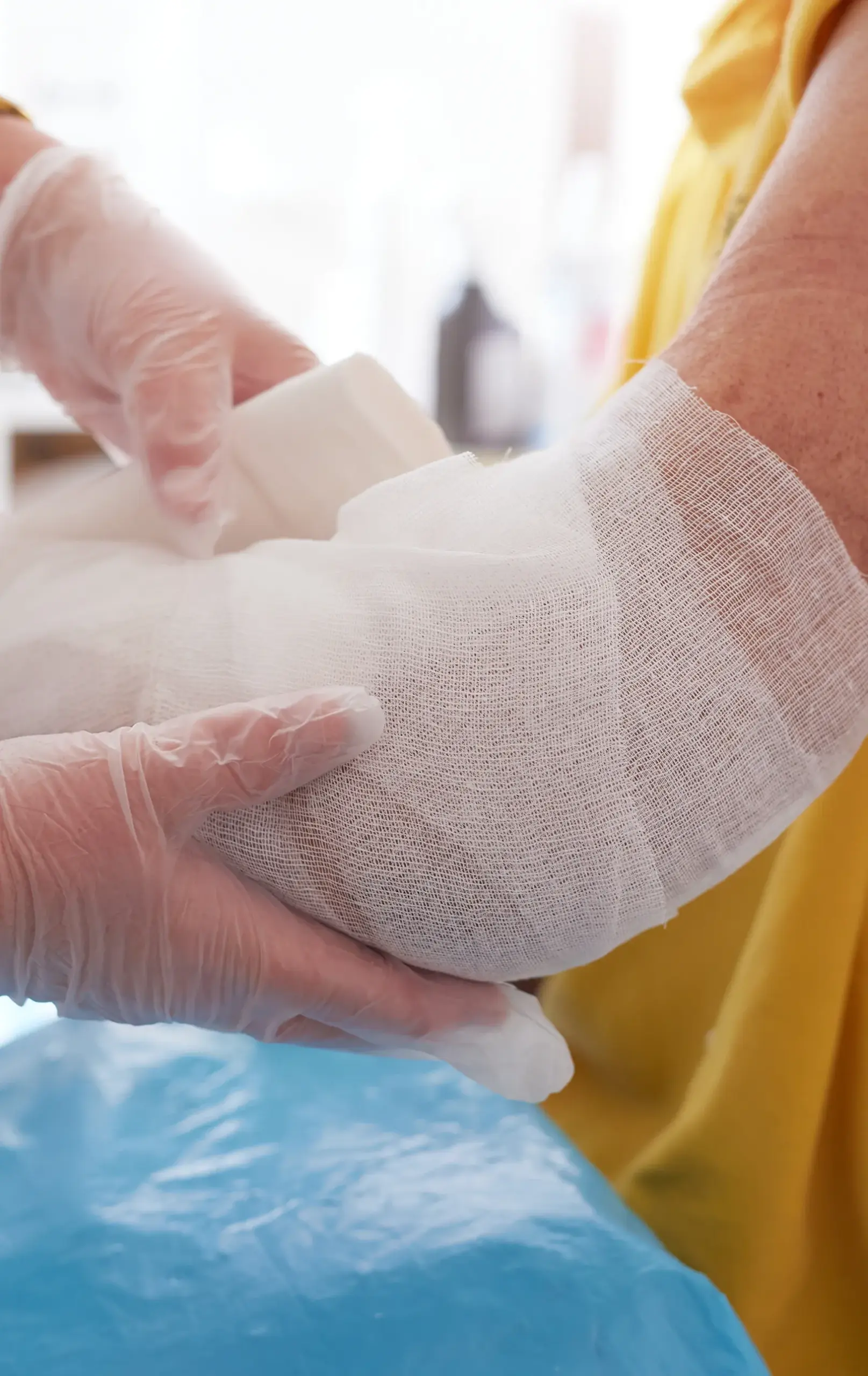 Healthcare provider wearing disposable gloves wrapping a white gauze bandage around a patient's injured arm and elbow.